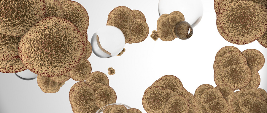 Research progress of stem cell transplantation on neuromuscular diseases